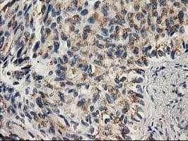 PNMT Antibody (clone OTI1B11)