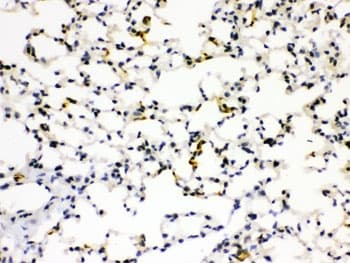 AGER / RAGE Antibody