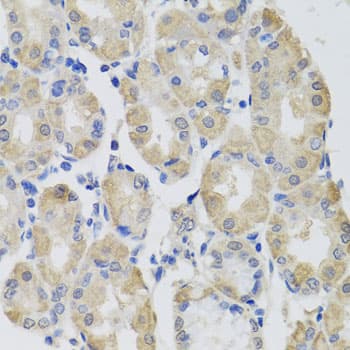 Polyclonal Rabbit anti-Human GPT / Alanine Transaminase Antibody (IHC, WB)