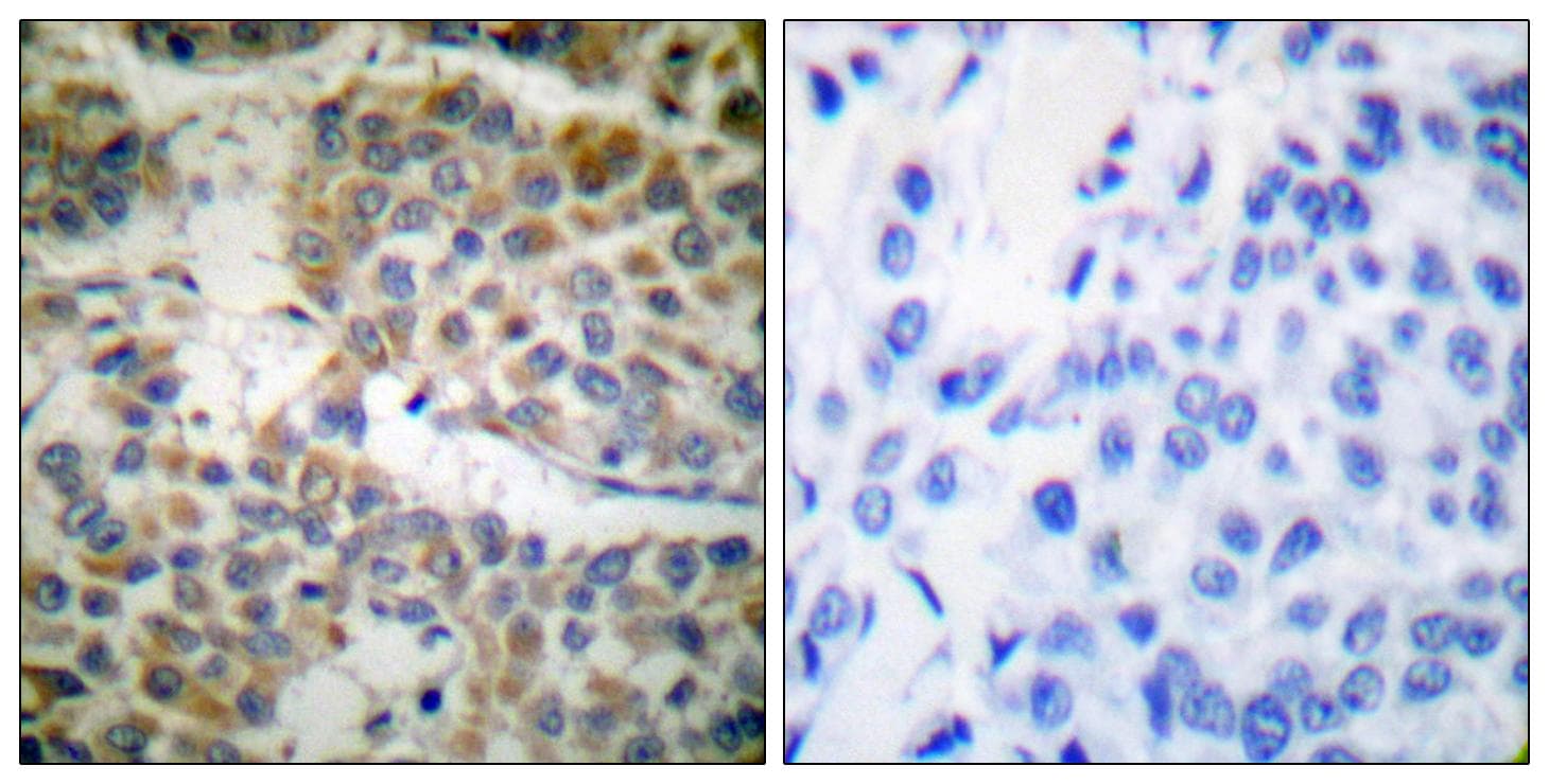 p66 / SHC Antibody (p349)