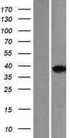 MEF2B Protein (Over-Expression Lysate Myc-DDK (Flag))