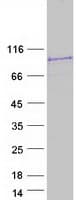 Human STRN4 Protein (Recombinant Myc-DDK (Flag))