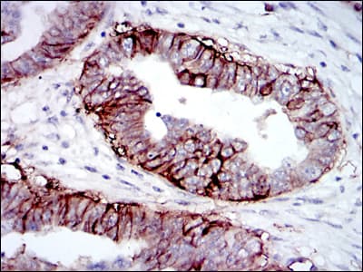 IGF1R / IGF1 Receptor Antibody (clone 3G5C1)