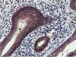 Cystatin SA / CST2 Antibody (clone OTI1D6)