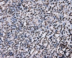 DAPK2 / DAP Kinase 2 Antibody (clone OTI1C5, Carrier-free)