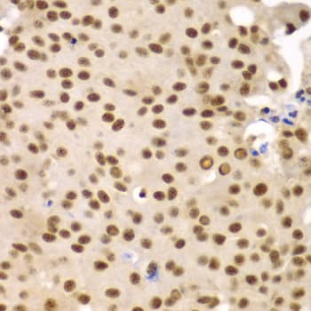 Polyclonal Rabbit anti-Human SF3B2 Antibody (IHC, IF, WB)