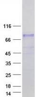 Human ARA70 / NCOA4 Protein (Recombinant Myc-DDK (Flag))