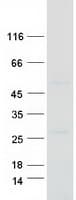 Human SEPT7 / Septin 7 Protein (Recombinant Myc-DDK (Flag))