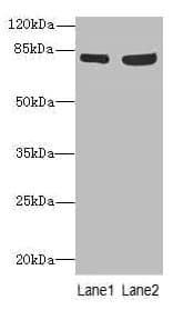 TARS Antibody