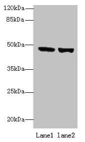 Polyclonal Rabbit anti-Human FAM46B Antibody (WB)