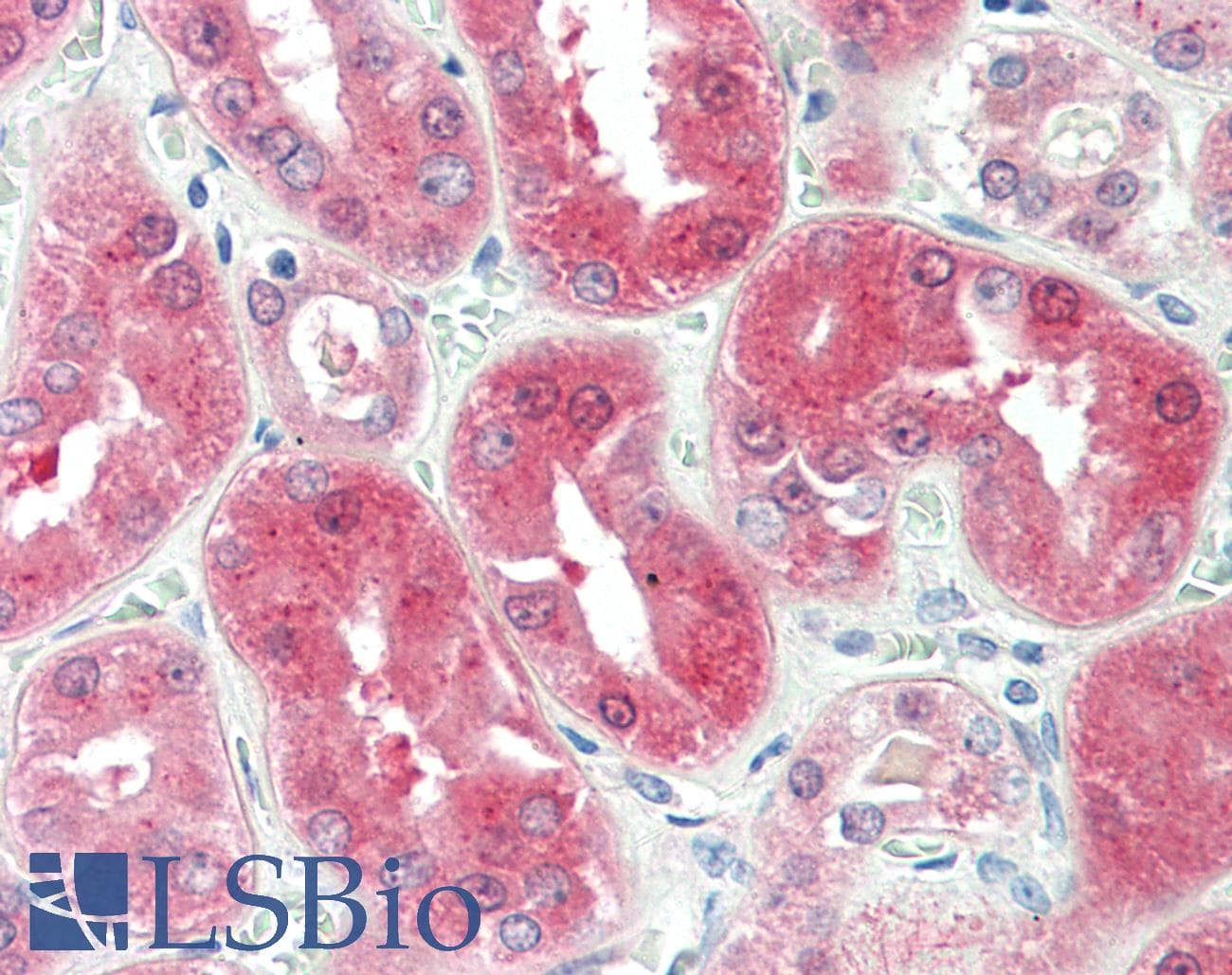 IHC-plus™ Polyclonal Goat anti-Human BDH2 Antibody (aa60-71, IHC, WB)
