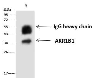 AKR1B1 / Aldose Reductase Antibody