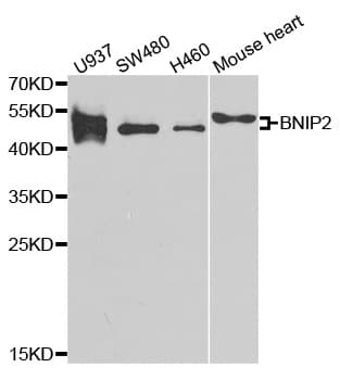 Polyclonal Rabbit anti-Human BNIP2 Antibody (IHC, IF, WB)