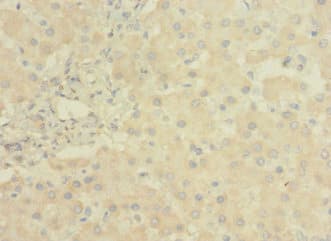 Polyclonal Rabbit anti-Human LRRC31 Antibody
