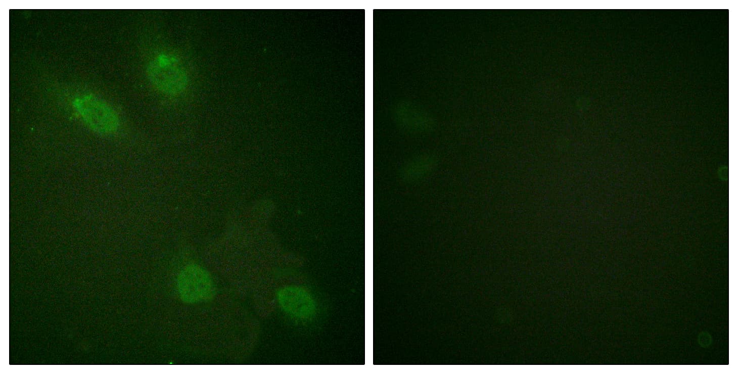 MED1 / TRAP220 Antibody (aa1423-1472)