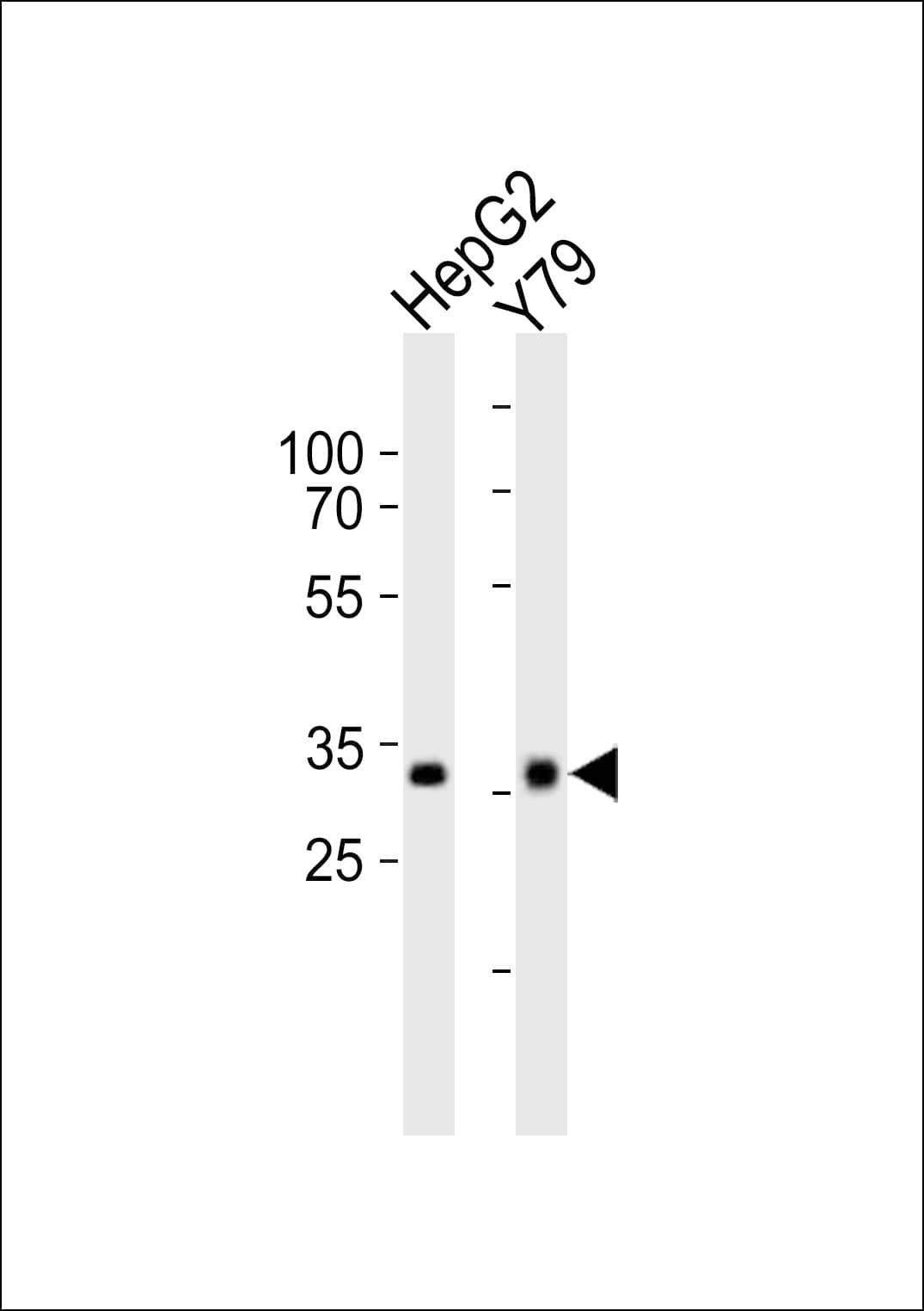 OTX2 Antibody (aa201-226)
