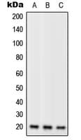Polyclonal Rabbit anti-Human RPL11 / Ribosomal Protein L11 Antibody (C-Terminus, IF, WB)