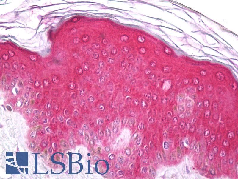 IHC-plus™ EPHA1 / EPH Receptor A1 Antibody (aa913-943)