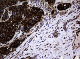 HSPD1 / HSP60 Antibody (clone OTI6F7)