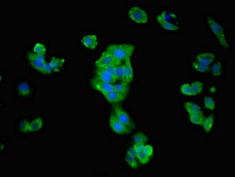 ATP1B1 Antibody