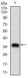 ABCB1 / MDR1 / P Glycoprotein Antibody (aa632-693, clone 6G11F8)