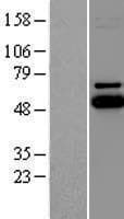 UBE2Q1 Protein (Over-Expression Lysate Myc-DDK (Flag))