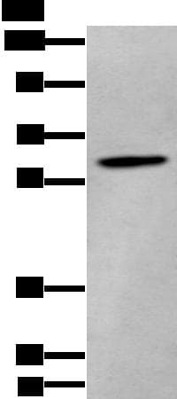 ZKSCAN1 / ZNF36 Antibody