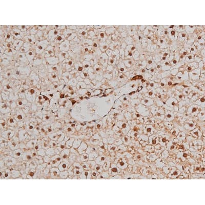 Polyclonal Rabbit anti-Human FLNA / Filamin A Antibody (phospho-Ser2152, IHC, IF, WB)
