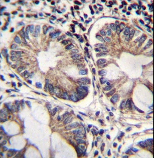 Polyclonal Rabbit anti-Human ME2 / Malate Dehydrogenase 2 Antibody (aa527-556, IHC, WB)