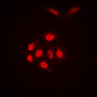 Histone H4 Antibody (Acetyl-Lys16)