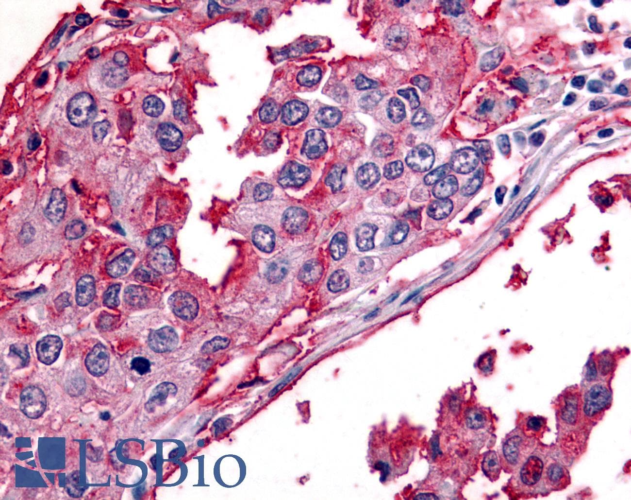 IHC-plus™ BEST2 / Bestrophin-2 Antibody (Internal)