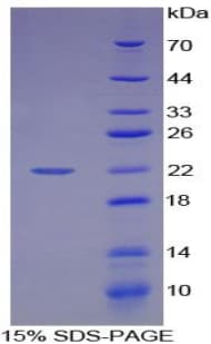 Human HMG1 / HMGB1 Protein (Recombinant His-T7)