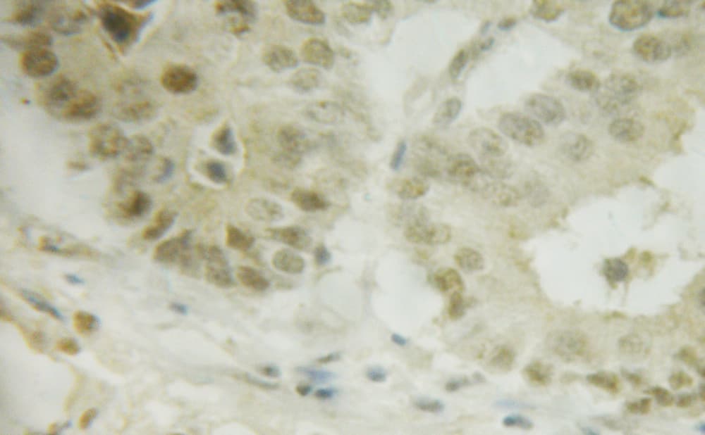 Polyclonal Rabbit anti-Human IRF3 Antibody (phospho-Ser385, IHC, IF, WB)