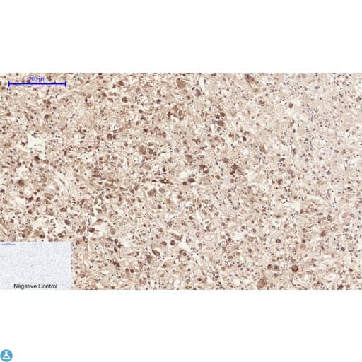 Polyclonal Rabbit anti-Human ANXA1 / Annexin A1 Antibody (IHC, WB)