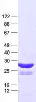 Human OSR1 Protein (Recombinant His, N-Terminal)