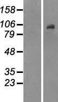 DNMT3B Protein (Over-Expression Lysate Myc-DDK (Flag))