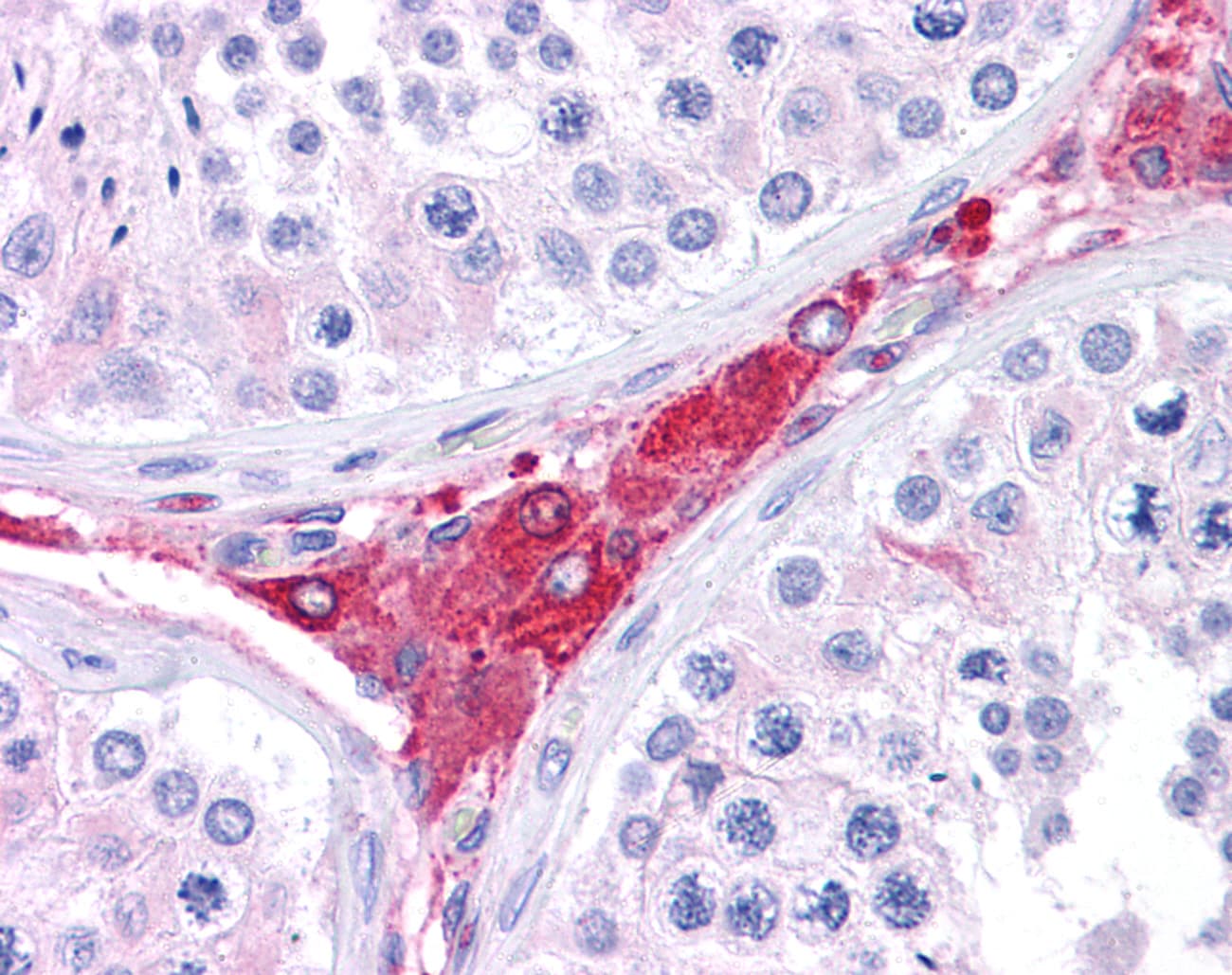 PathPlus™ BACE1 / BACE Antibody (aa72-121)
