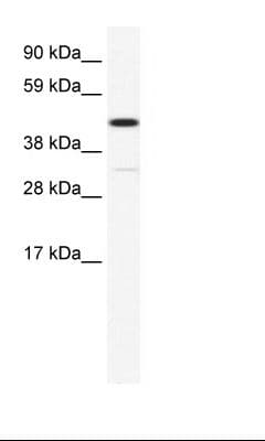 Polyclonal Rabbit anti-Mouse HOXA3 Antibody (N-Terminus, WB)