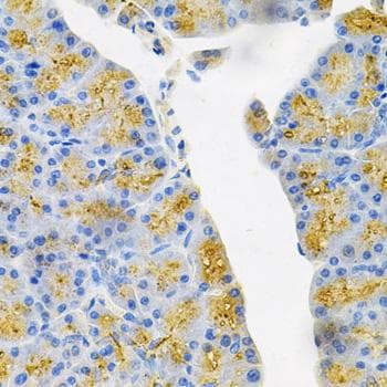Endothelin 3 / EDN3 Antibody