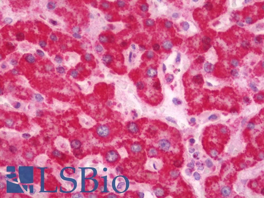 IHC-plus™ Polyclonal Rabbit anti-Human PRDX3 / Peroxiredoxin 3 Antibody (aa44-93, IHC, WB)