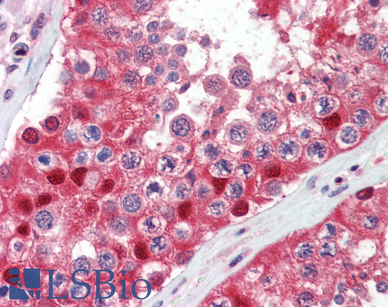 IHC-plus™ Ubiquitin Antibody (clone P4G7-H11)
