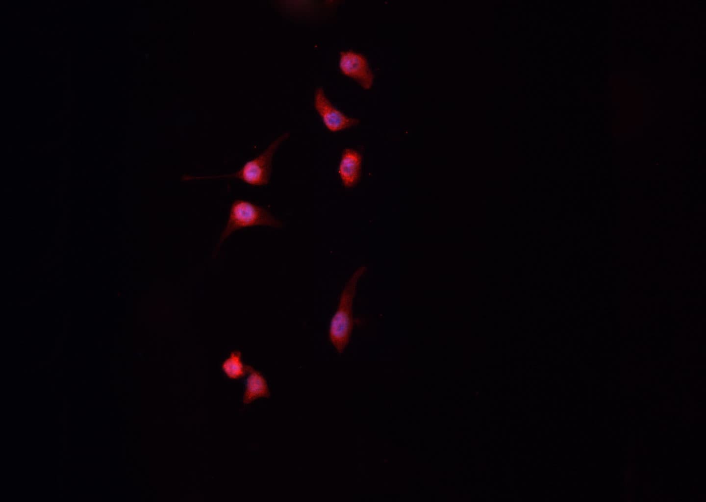BIRC5 / Survivin Antibody (phospho-Thr117)