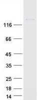 Human SPARCL1 / Hevin Protein (Recombinant Myc-DDK (Flag))