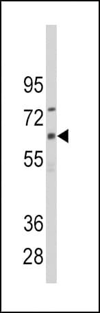 CYP1B1 Antibody (aa143-176)