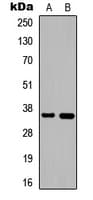 DNAJB2 Antibody (C-Terminus)
