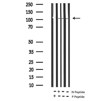 Polyclonal Rabbit anti-Human PDGFRB / PDGFR Beta Antibody (phospho-Tyr1021, IHC, WB)