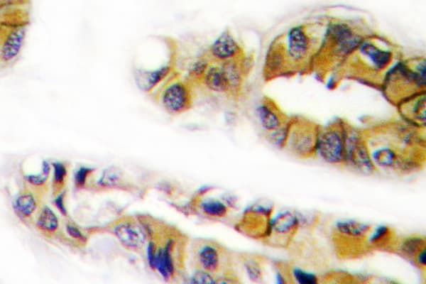 EGFR Antibody (Val1010)