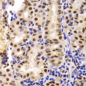 XRCC5 / Ku80 Antibody