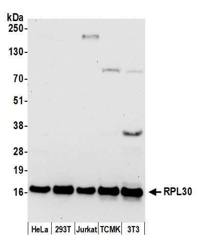 RPL30 / Ribosomal Protein L30 Antibody (aa1-50)