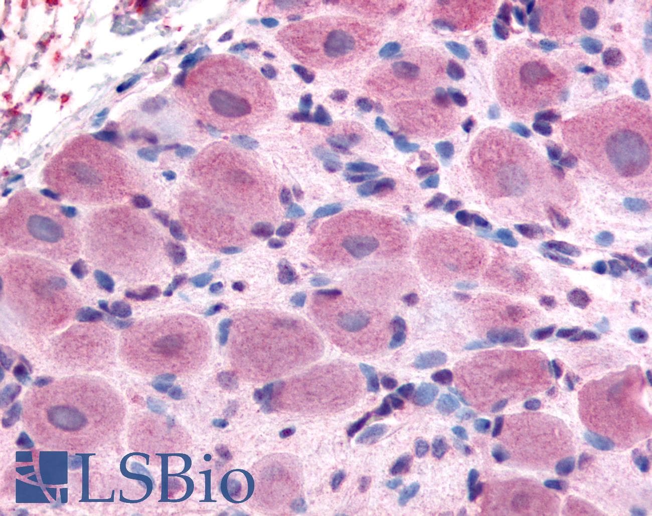 IHC-plus™ TRPA1 Antibody (Internal)